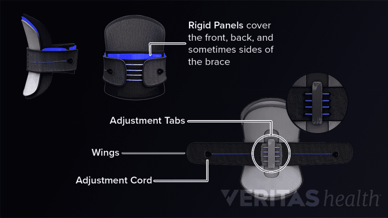 Medical illustration of a rigid brace and the different parts of the brace highlighted.