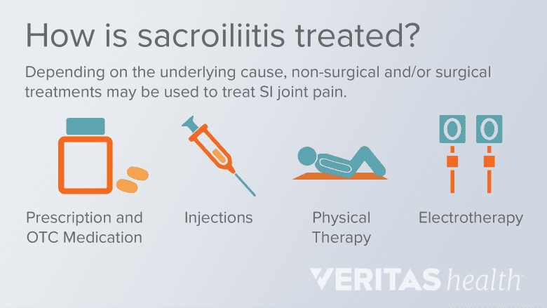 Non-surgical treatments for sacroiliitis. Left to right. Human reclining, syringe needle, Pill bottle and electrical plug