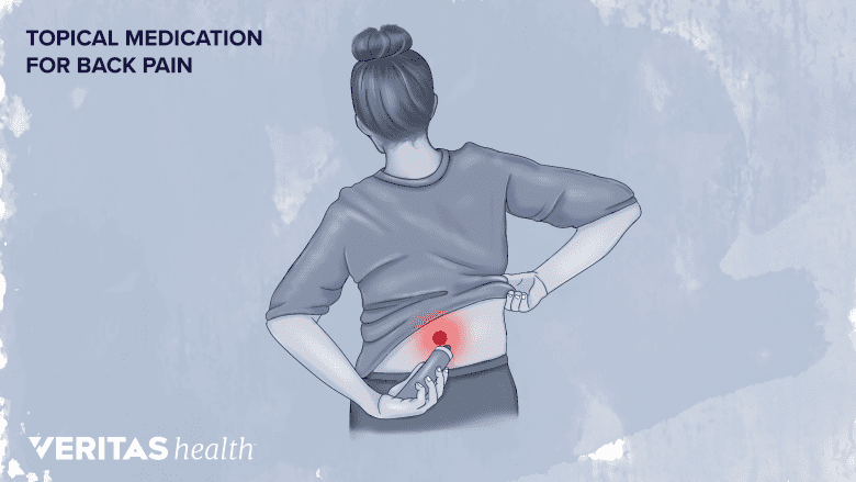Illustration showing a woman applying topical medication on her back and a red dot in the low back.