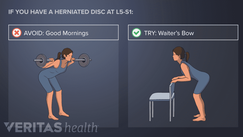 Avoid Good Mornings with lower back or L5-S1 disc herniation. Try Waiters Bow.