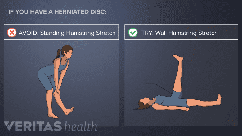 Avoid standing hamstring exercises with lower back disc herniation. Try a wall hamstring stretch.
