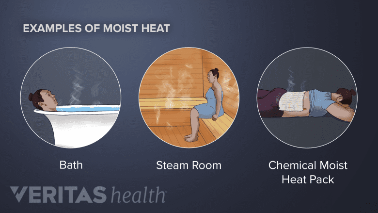Types of moist heat.