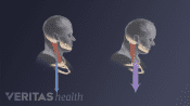 Pproper head posture and forward head posture