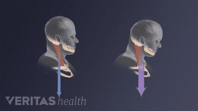 Pproper head posture and forward head posture
