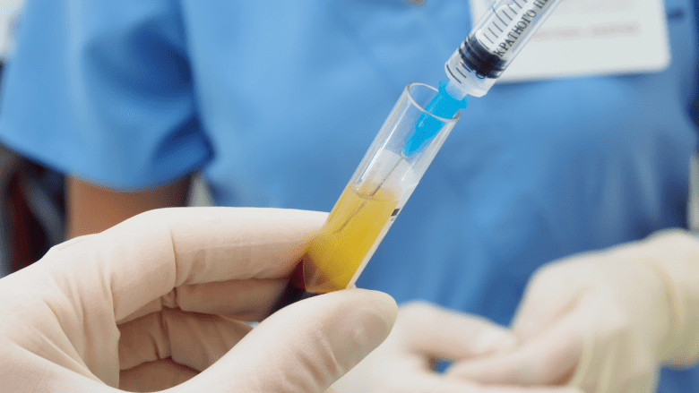 Hands holding separated blood and syringe in test tube at research laboratory.