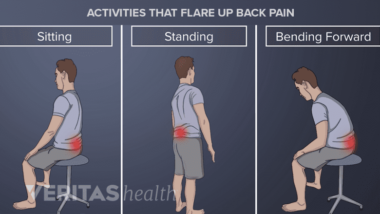 Activities that increase back pain, pinched nerve pain, and herniated disc pain