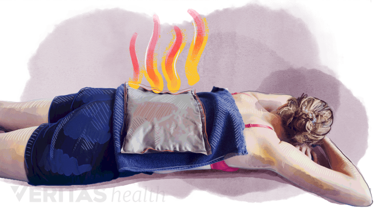 A woman receiving heat therapy on her back.